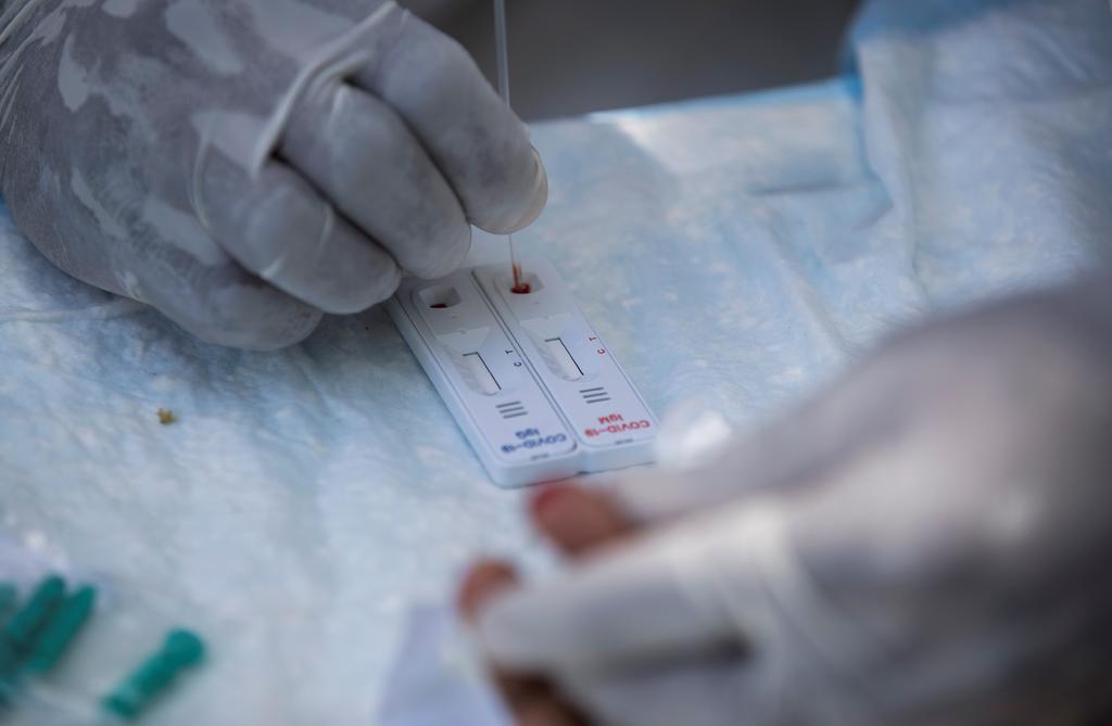La Comisión Federal para la Protección contra Riesgos Sanitarios (Cofepris) aprobó siete pruebas serológicas, también conocidas como pruebas rápidas, para determinar la presencia del virus SARS-CoV-2, causante de la enfermedad COVID-19. (ARCHIVO)