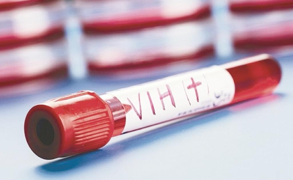 Según el estudio, el agente GS-6207 altera la cápside del VIH, la cubierta que encierra el genoma del virus, de forma que consigue interferir con éste (ESPECIAL) 