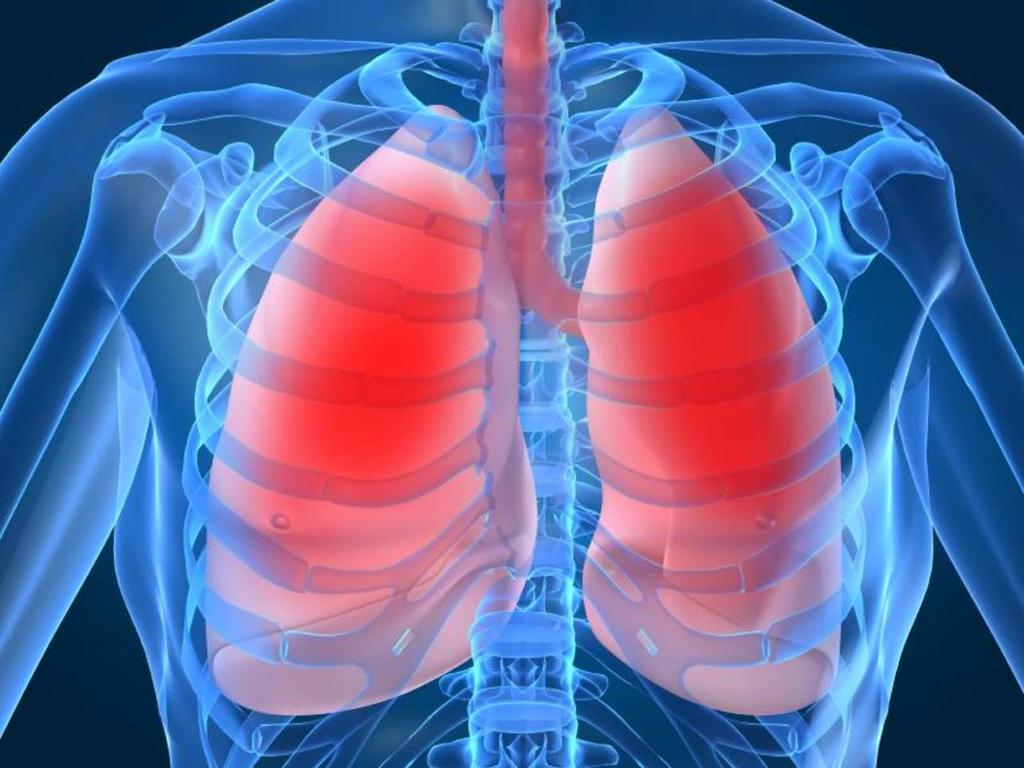 Los pulmones humanos que han sido rechazados para un trasplante de órganos pueden reacondicionarse a través de su conexión con el sistema circulatorio cerrado de los cerdos. (ARCHIVO) 