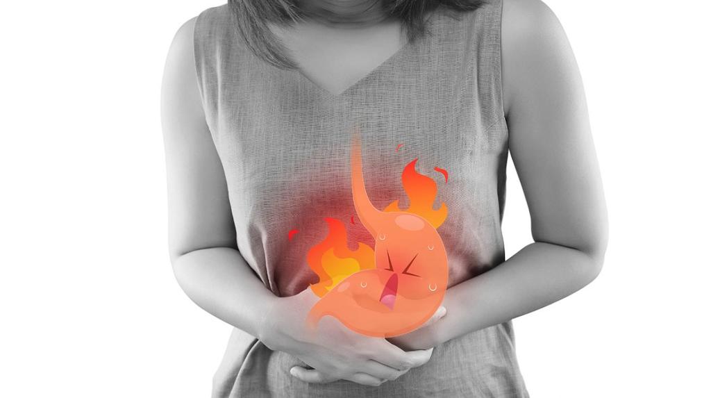  La acidez estomacal es una sensación de ardor o quemazón en el pecho, detrás del esternón. Esta sensación suele empeorar después de comer, por la noche o cuando uno se acuesta. (INTERNET) 