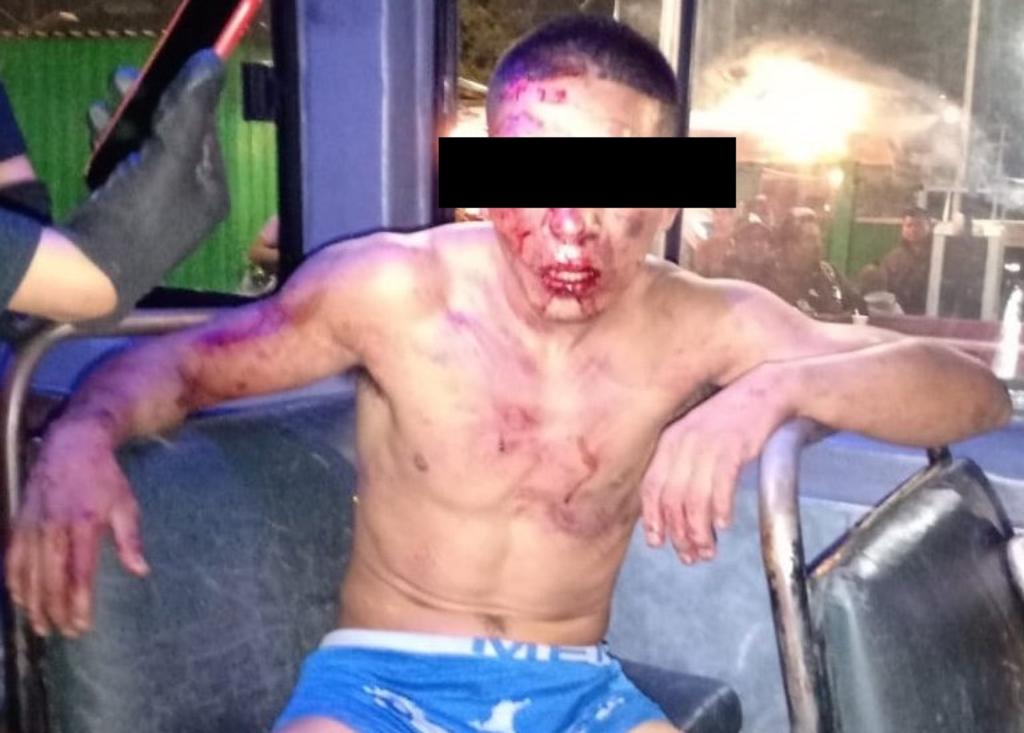 El sujeto fue atendido por personal del Ministerio Público tras recibir los golpes por parte de los pasajeros de la unidad de transporte público (CAPTURA)  