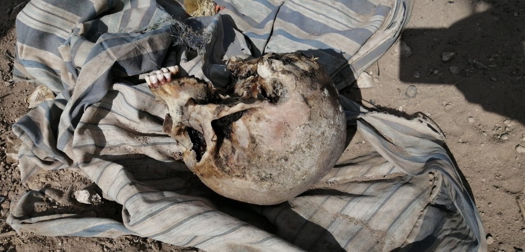 De acuerdo con las primeras investigaciones, todo indica que el cráneo pertenece a un hombre. (EL SIGLO DE TORREÓN)