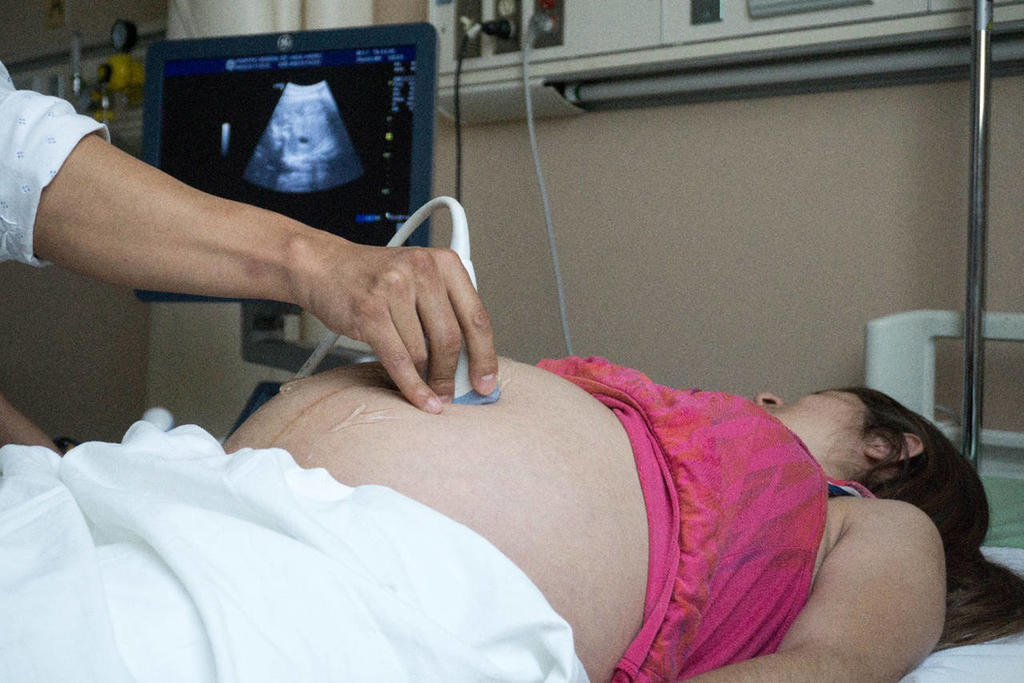 En México, hasta el 13 de septiembre, 5 mil 574 mujeres embarazadas o en puerperio (primeras semanas después del parto) se han contagiado de COVID-19. Por otro lado, se han registrado 140 fallecimientos. (ESPECIAL) 