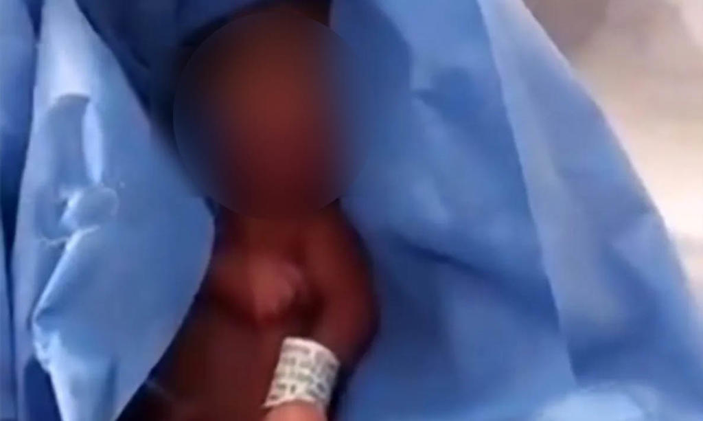 Mediante un comunicado el Hospital General de Zona No. 20 La Margarita del IMSS, afirmó que se le había realizado una evaluación al bebé al momento de su nacimiento, determinando que el infante no presentaba signos vitales (ESPECIAL) 