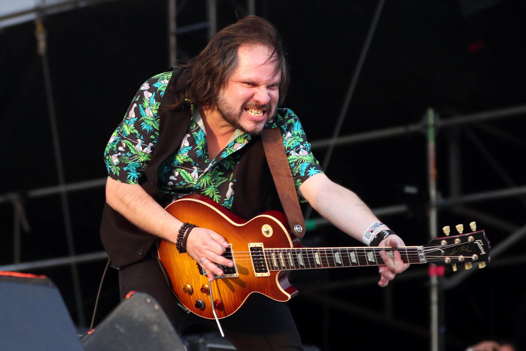 Amor a la música. El guitarrista lleva cinco operaciones en el cerebro, pero dice que se siente bien para seguir tocando.