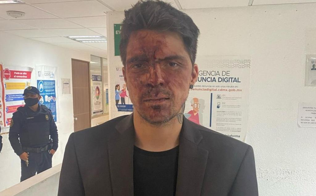 César, hijo menor de Lupita D'Alessio denunció que fue brutalmente golpeado en la casa del exgobernador del Estado de México, Arturo Montiel.  (FACEBOOK) 
