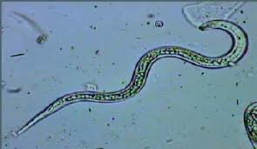 El estudio internacional PineWALL, liderado por la Universidad de Coimbra (Portugal), apunta a la pared celular de los árboles como la clave para acabar con la plaga de nematodo del pino que afecta a la Península Ibérica. (ESPECIAL) 
