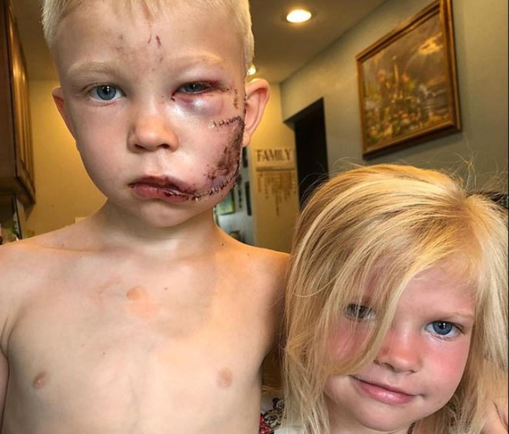 Hace algunos meses un niño se volvió viral tras proteger a su hermana del ataque de un Pitbull en Cheyenne, Wyoming, convirtiéndose en un héroe mundial. (Especial) 