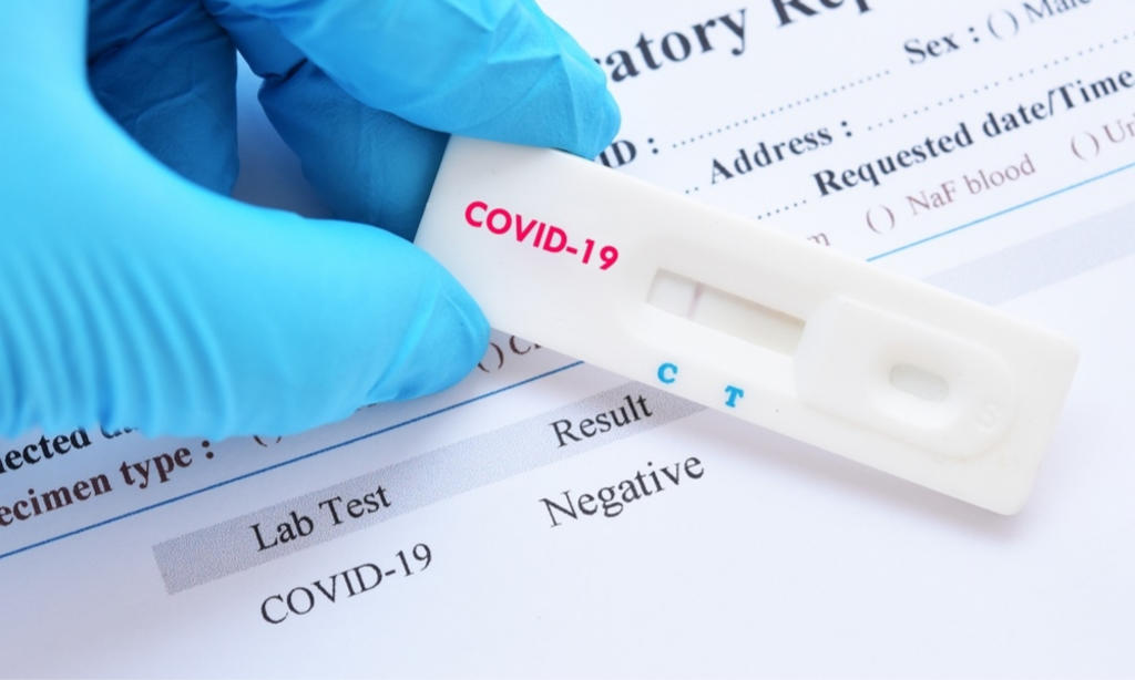 La prueba podría detectar anticuerpos generados por COVID-19 con tan sólo una mínima muestra sanguínea (ESPECIAL)  