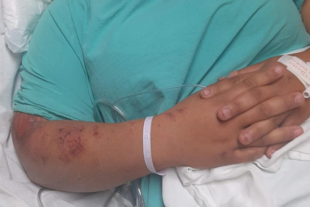 Joven motociclista sufre accidente, terminó hospitalizada en Gómez Palacio. (EL SIGLO DE TORRÉON) 