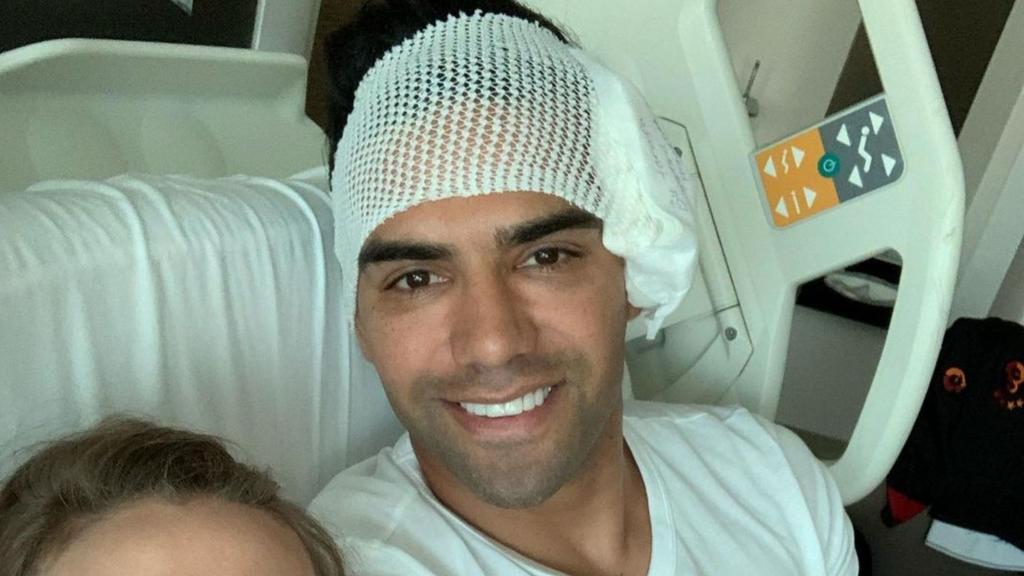 Radamel Falcao ha compartido este lunes una fotografía en la que se le ve sonriendo y con buen aspecto, aunque con la cabeza vendada, en la cama del hospital de Estambul donde está ingresado por la fractura en el pómulo que sufrió el domingo en un entrenamiento. (ESPECIAL)