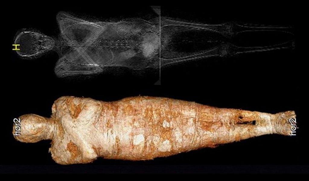 Aunque su cuerpo embalsamado estaba en un ataúd para un sacerdote masculino, una investigación en profundidad ha permitido encontrar el primer caso conocido de la momia de una mujer embarazada, según un estudio que publica Journal of Archaelogical Science. (ESPECIAL) 
