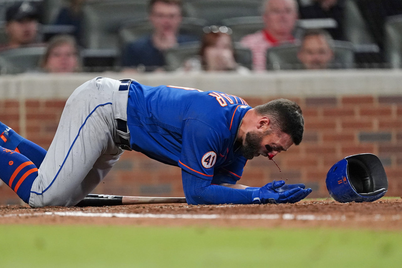 Kevin Pillar de los Mets sufre múltiples fracturas tras recibir pelotazo en la nariz