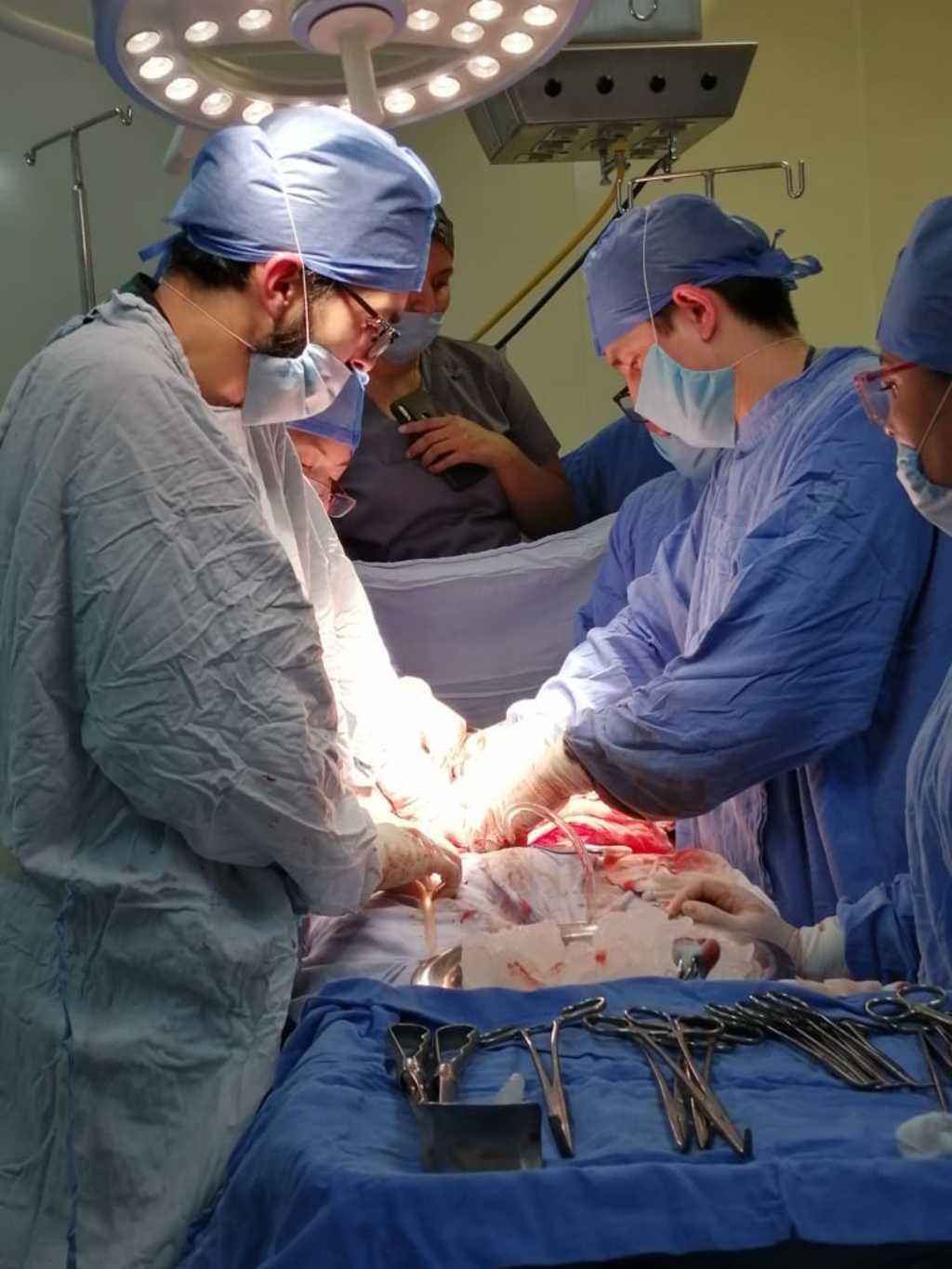 De los 44 trasplantes realizados en la UMAE número 71, 28 fueron renales y el resto, de córnea.