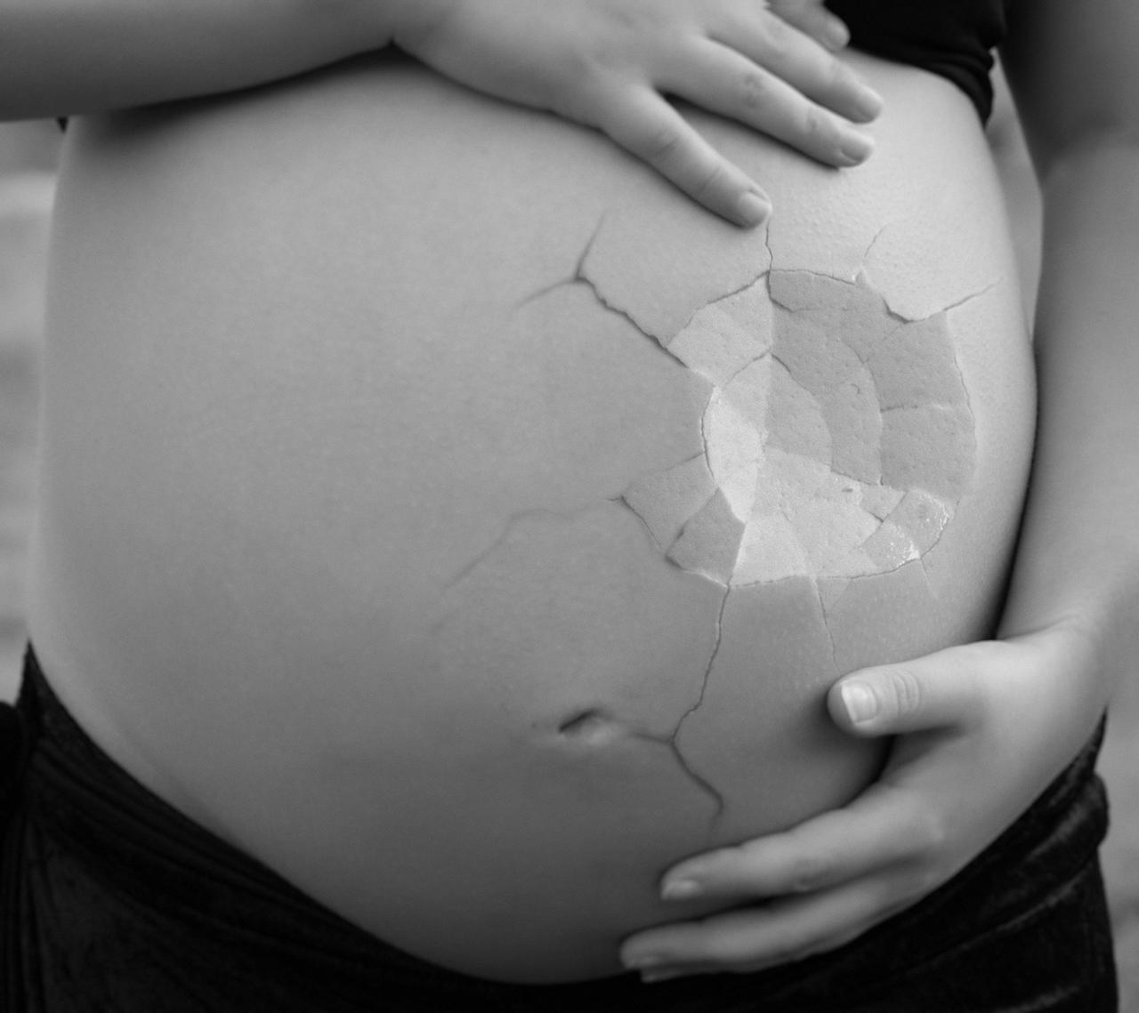 En 2020 acompañaron entre 150 y 200 mujeres que decidieron interrumpir su embarazo. (PIXABAY)