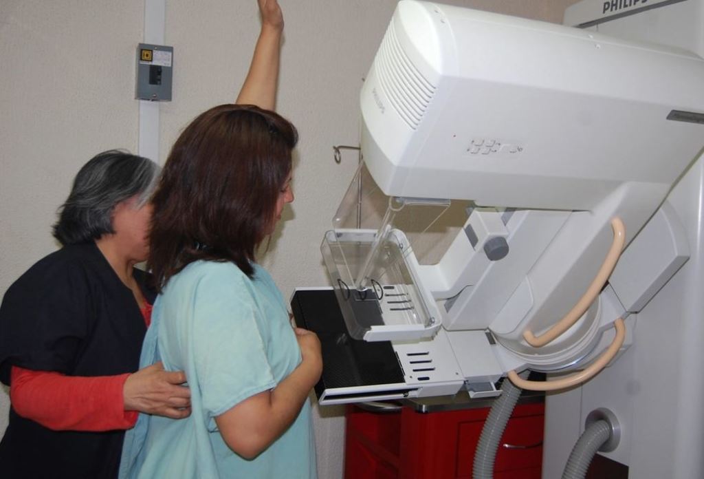 La mastografía se realiza de forma gratuita y es el método más eficaz para detectar oportunamente el cáncer de mama. (ARCHIVO)