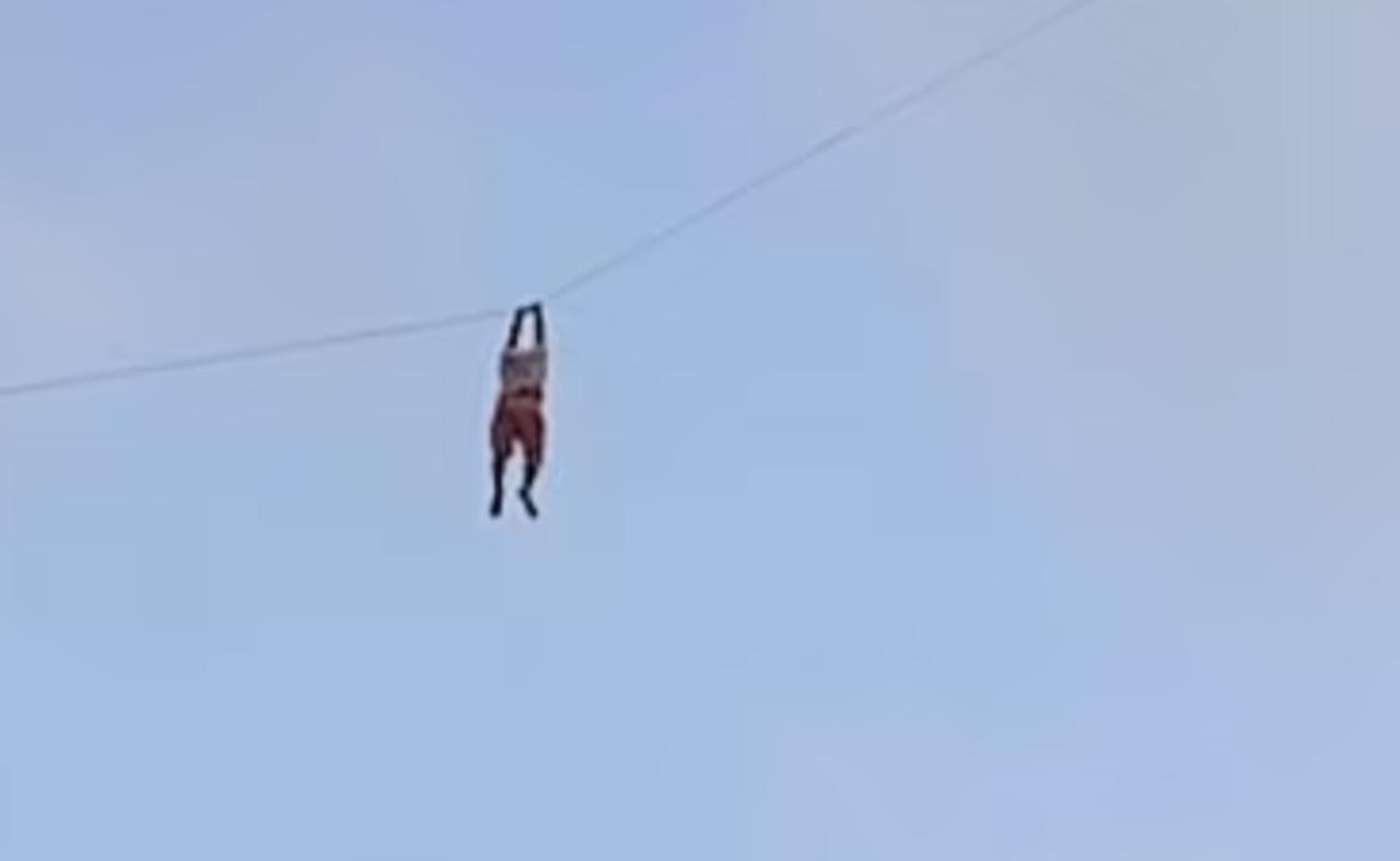 El hombre sólo sufrió heridas de poca gravedad (CAPTURA)