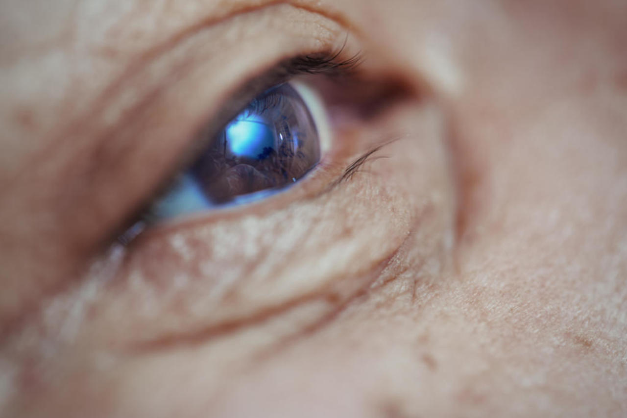 Una anciana británica de 88 años que había perdido la visión en el ojo izquierdo se ha convertido en la primera paciente en el Reino Unido que detecta señales en ese ojo usando un nuevo y revolucionario chip biónico. (ESPECIAL)