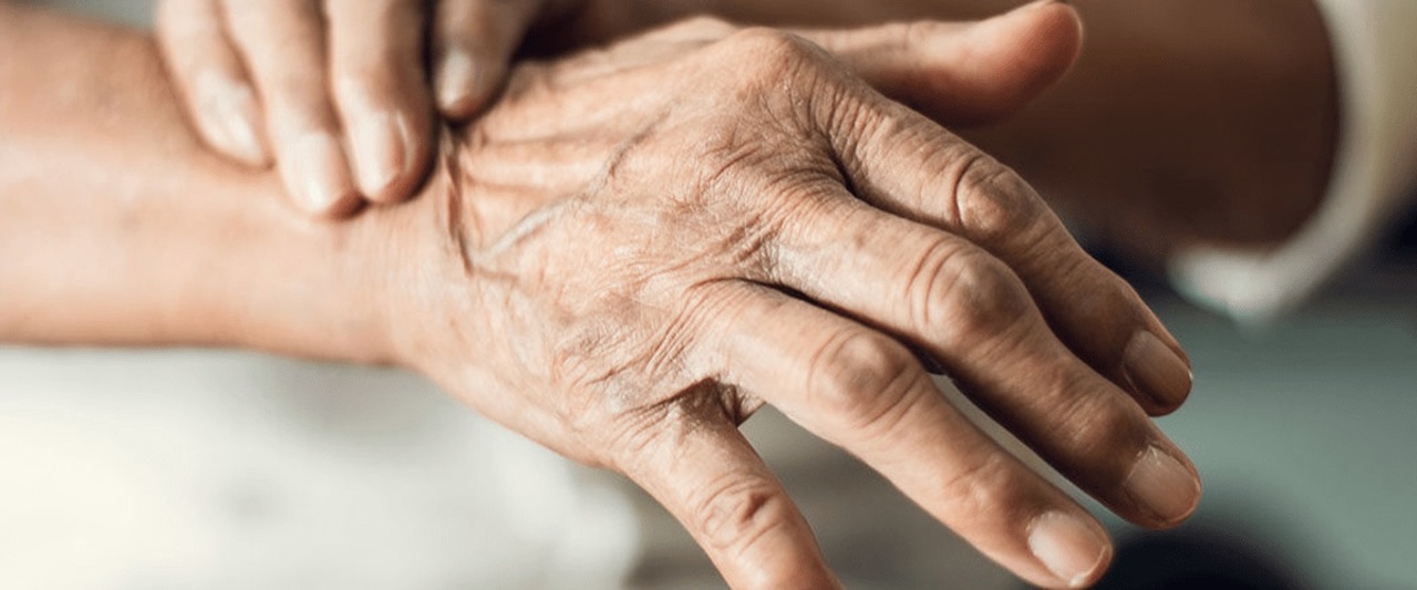 La enfermedad de Parkinson es incurable y afecta principalmente a los adultos mayores de 60 años de edad. (EL SIGLO DE TORREÓN)