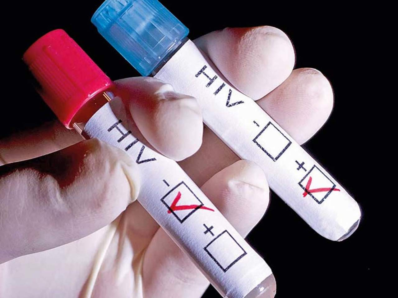 Una variante del VIH, más virulenta y con más riesgo de transmisión, ha estado circulando las últimas décadas en Países Bajos, aunque tras iniciar el tratamiento los afectados tienen una supervivencia similar al resto de enfermos, según un estudio que publica Science. (ESPECIAL) 