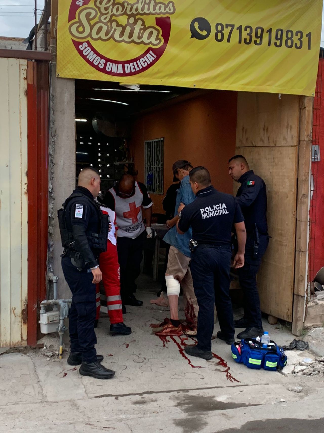 El sujeto recibió un disparo en una pierna, asegura que lo agredieron cuando hacía sus necesidades en un terreno baldío.