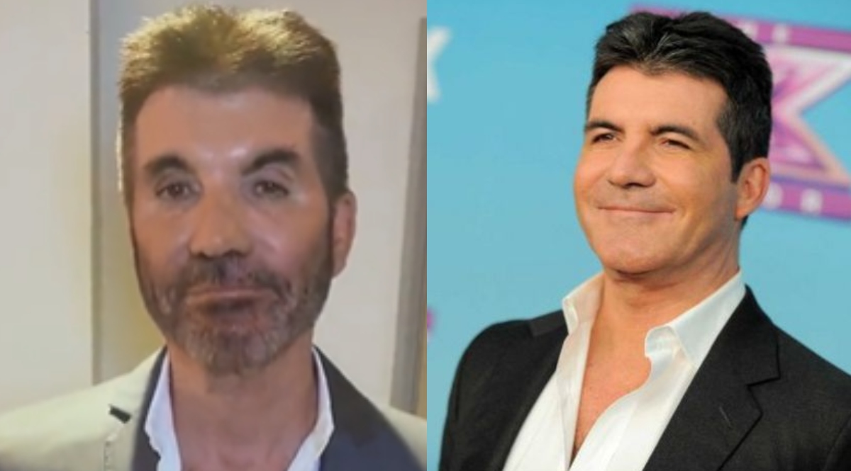 Qué Le Pasó Simon Cowell Es Blanco De Críticas Tras Cambio Radical En Su Rostro El Siglo De 9131