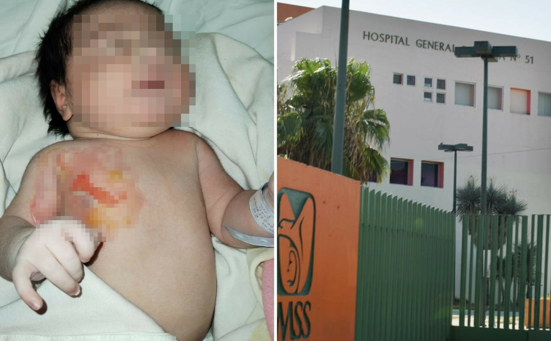 La bebé llevará el nombre de Diana y está hospitalizada en la clínica No. 51 del IMSS ubicada en el sector conocido como Chapala.