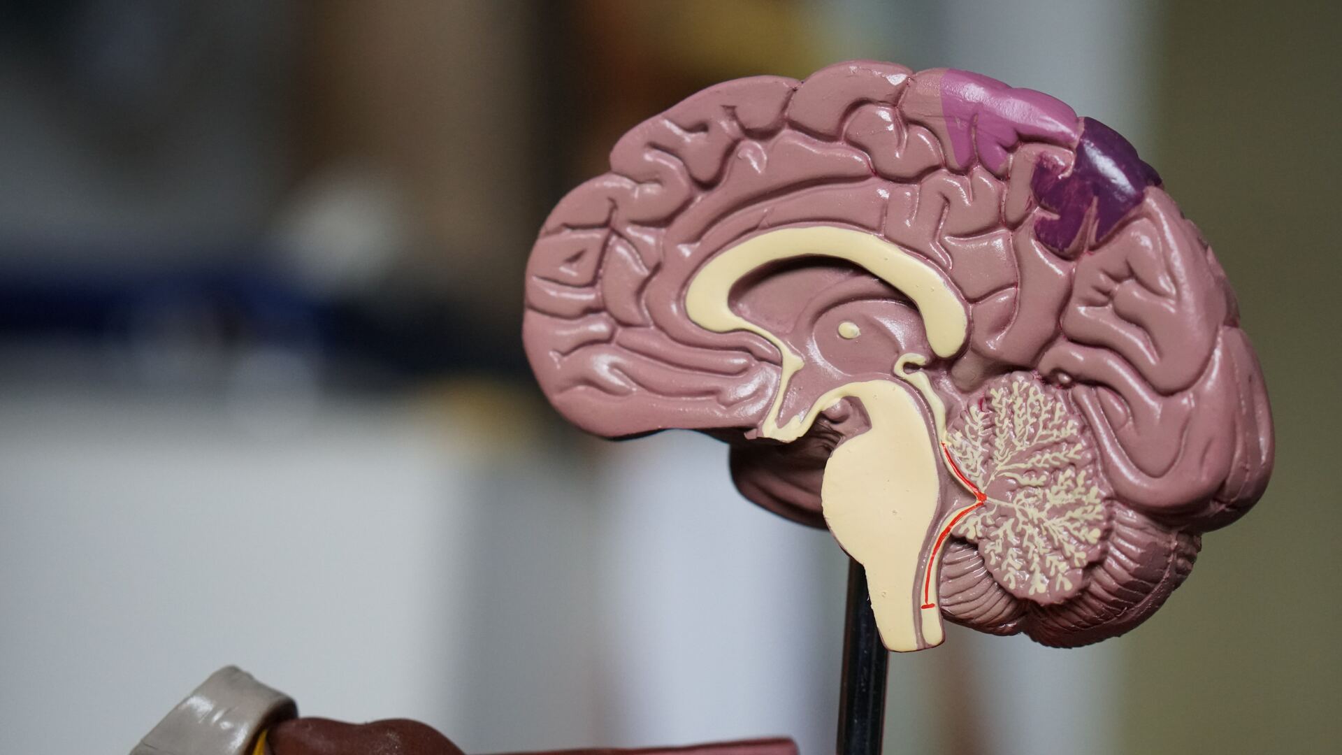 El grupo sanguíneo con más probabilidades de padecer Alzheimer