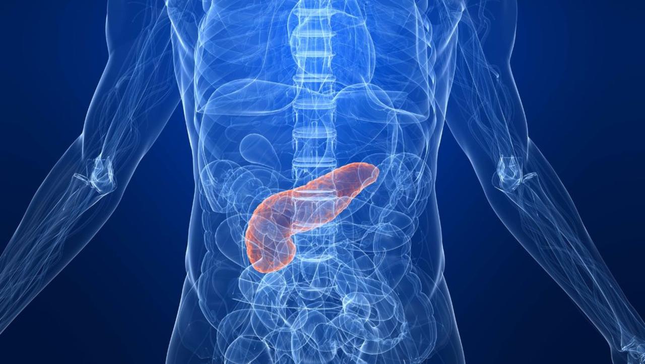 El cáncer de páncreas es un tumor altamente maligno, pero tiene el potencial de ser curable si se detecta muy temprano.