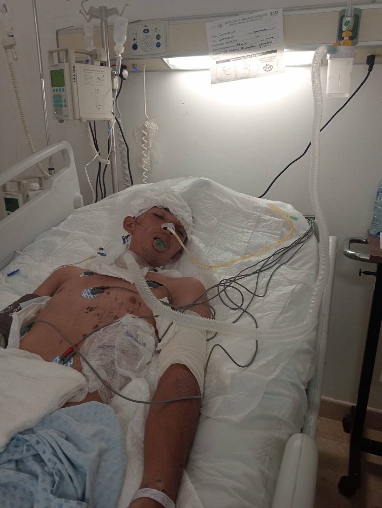 Joven migrante se mantiene en calidad de desconocido, perdió sus dos piernas y se encuentra en coma en el Hospital Nuevo de Gómez Palacio.
