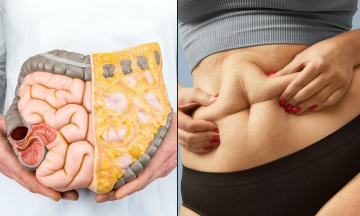 ¿Qué es la grasa visceral y cómo eliminarla?