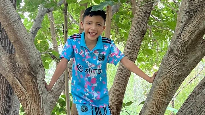 Lagunero de 8 años, busca reunir recursos para su cirugía a través de GoFundMe