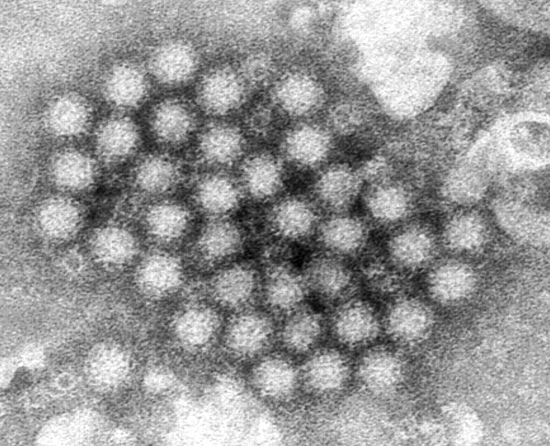 Sistemas de Salud en Estados Unidos y Reino Unido en alerta por norovirus, ¿Qué sucede?