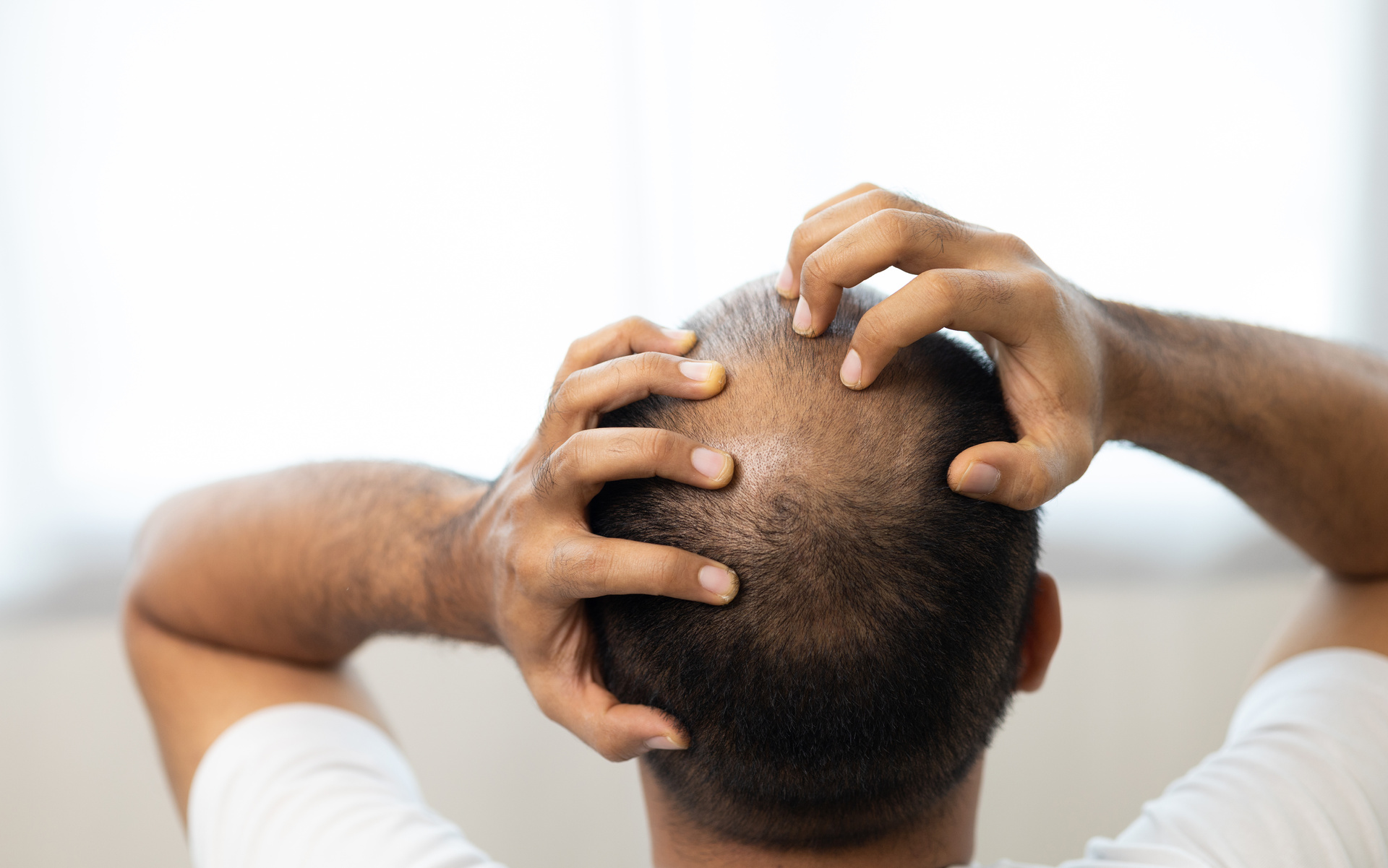 La mejor manera de manejar las emociones al perder el cabello