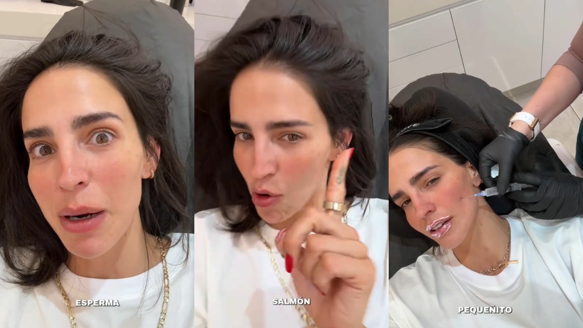 Bárbara de Regil desata reacciones tras inyectarse esperma de salmón