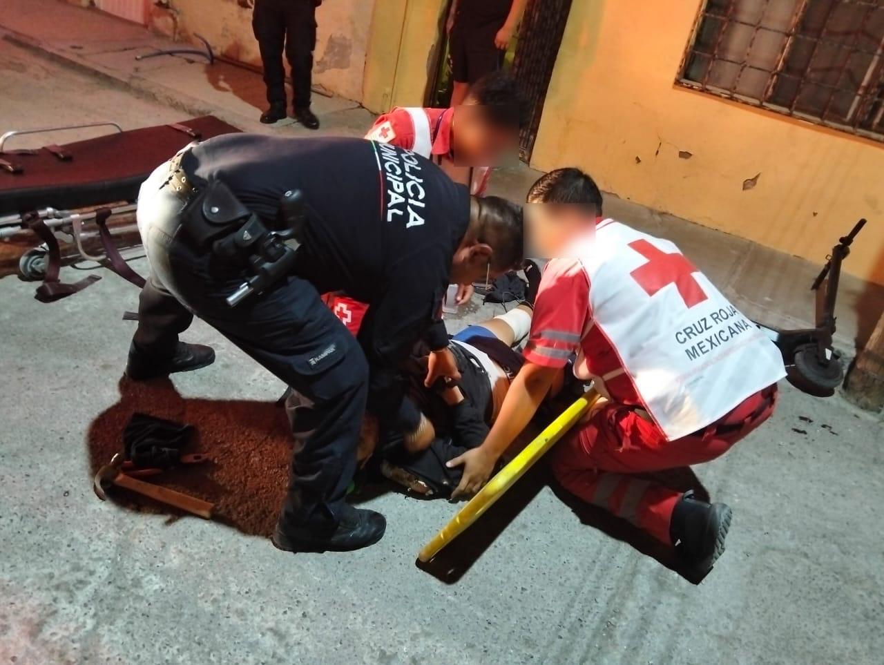 Ladrón termina con una pierna fracturada al tratar de huir