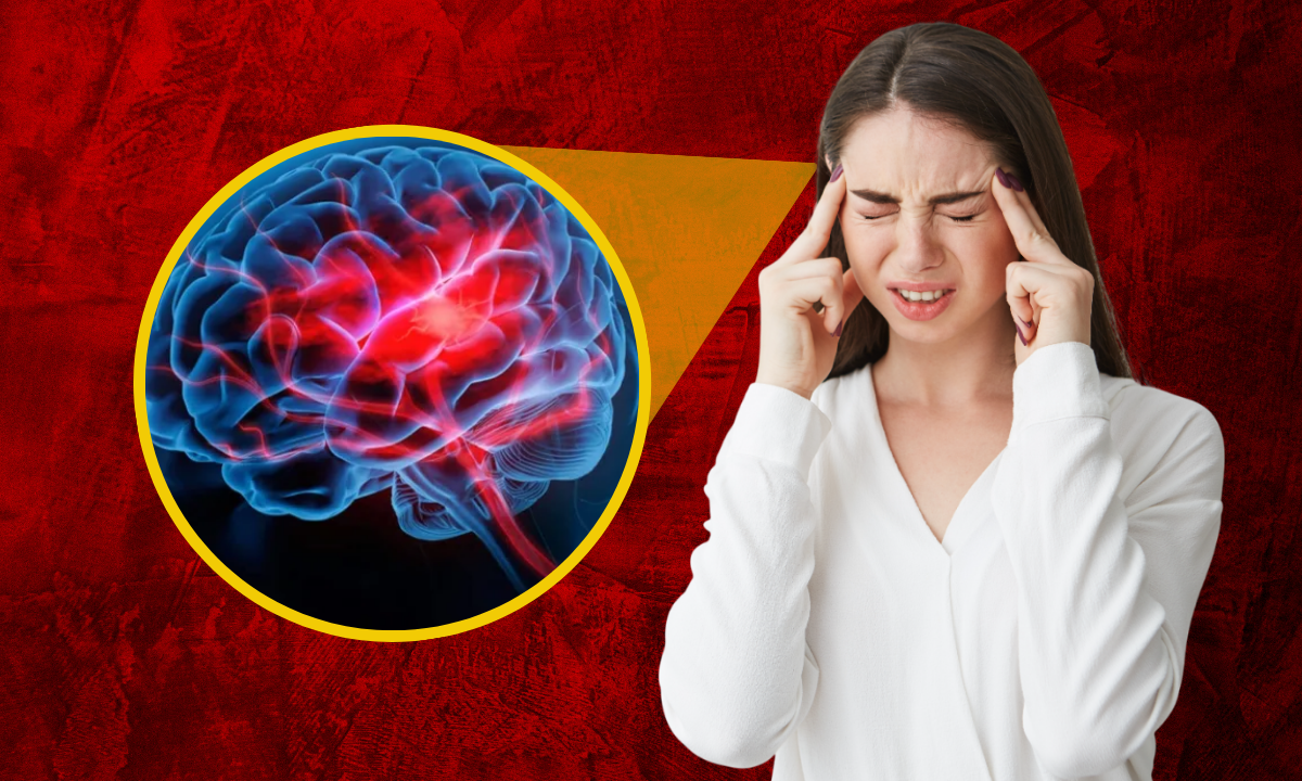 ¿Cómo diferenciar entre el dolor de cabeza y un derrame cerebral?