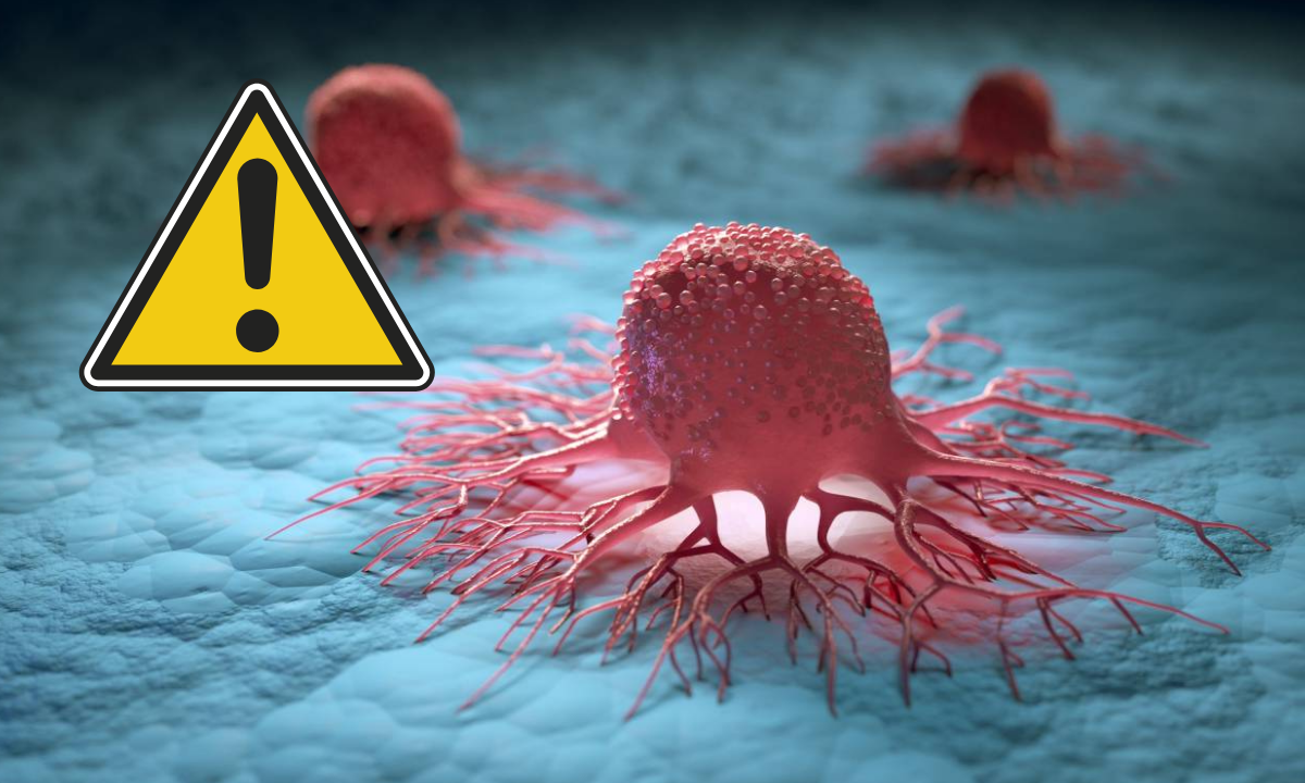 El tipo de cáncer silencioso que va en aumento en adultos mayores
