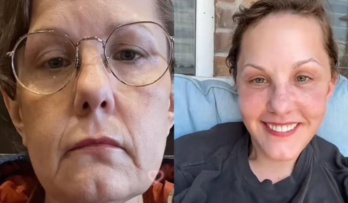 La mujer viral de TikTok que rejuveneció 30 años gracias a una cirujana de Guadalajara