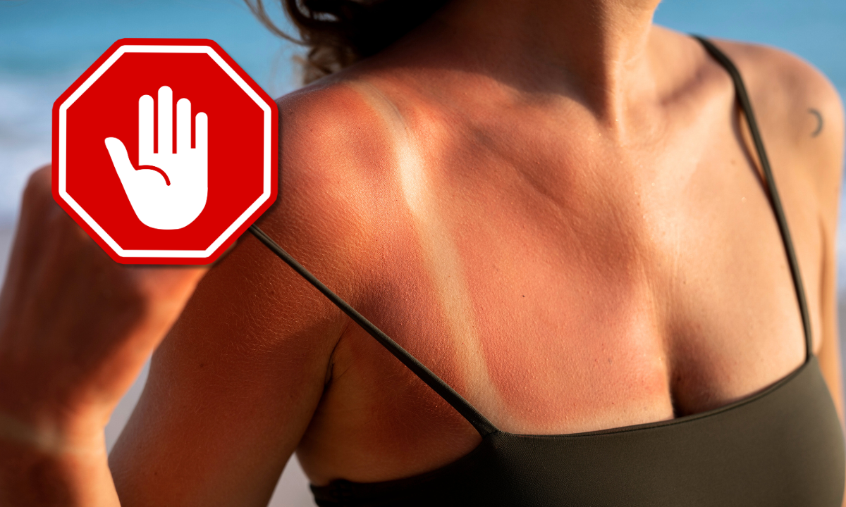 Por qué broncearse es muy peligroso para la salud de la piel