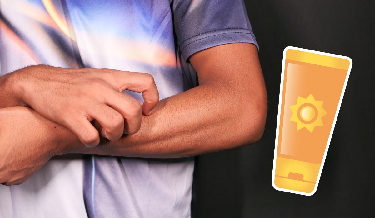 ¿Cómo saber si soy alérgico al sol? Así puedes tratar este tipo de alergia