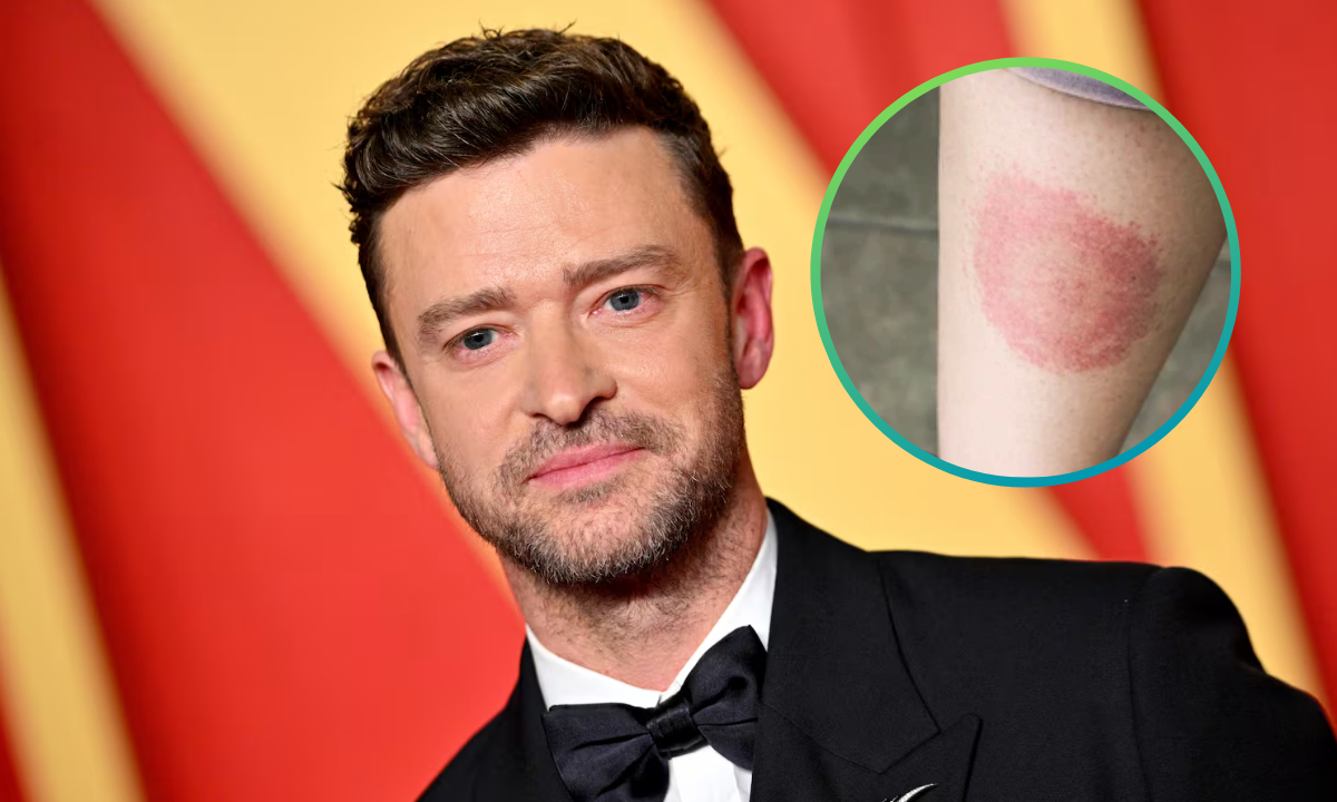 Justin Timberlake revela que padece la enfermedad de Lyme ¿Qué es?