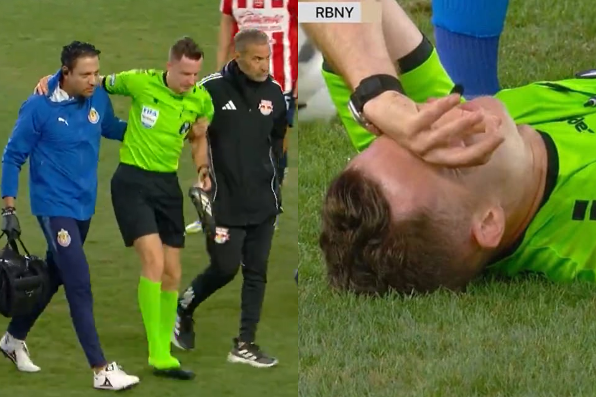 Árbitro de Chivas vs New York RB se lesiona y causa momentánea suspensión