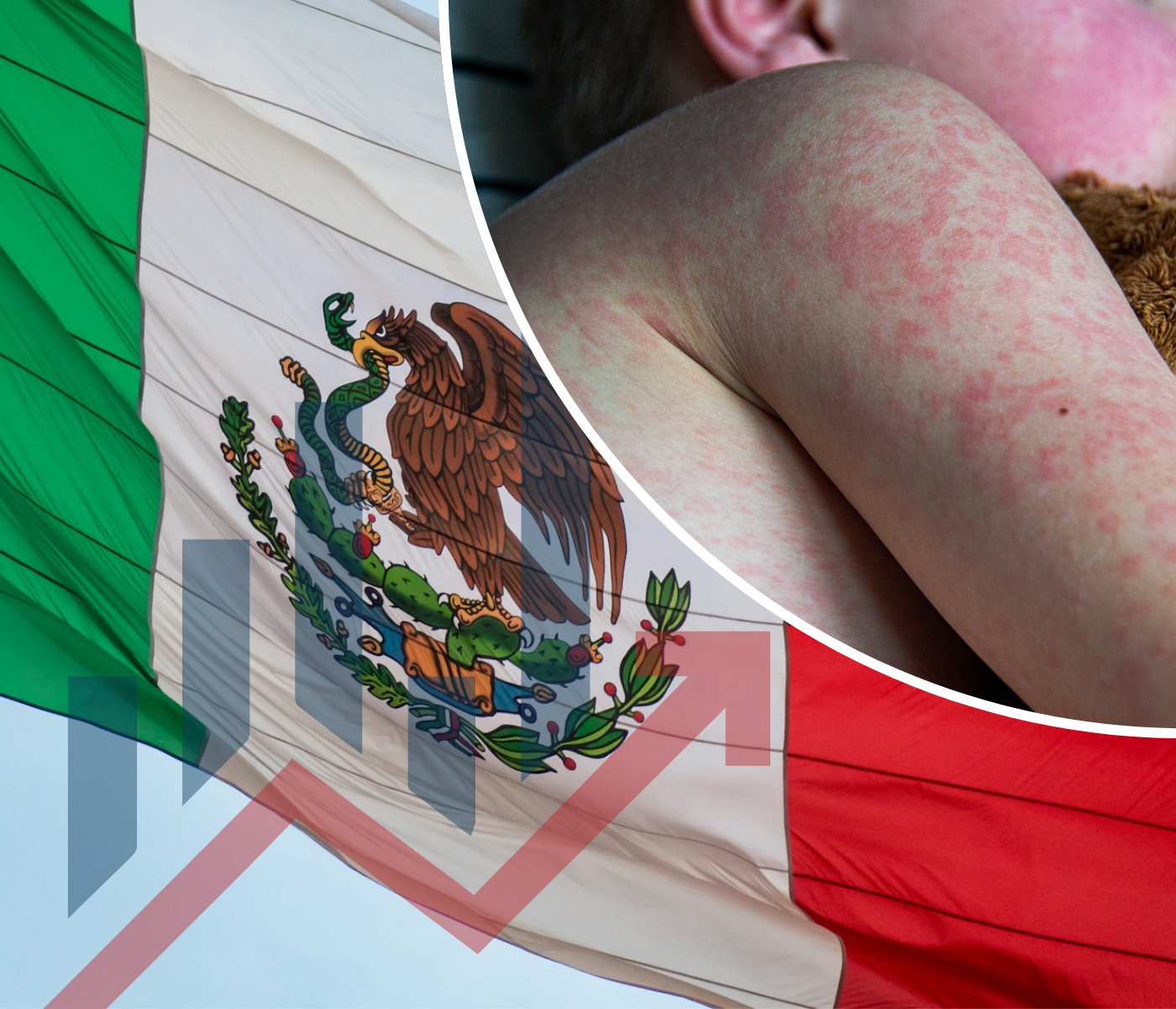 Ya se han registrado casos de sarampion en 21 estados de México. [Especial]